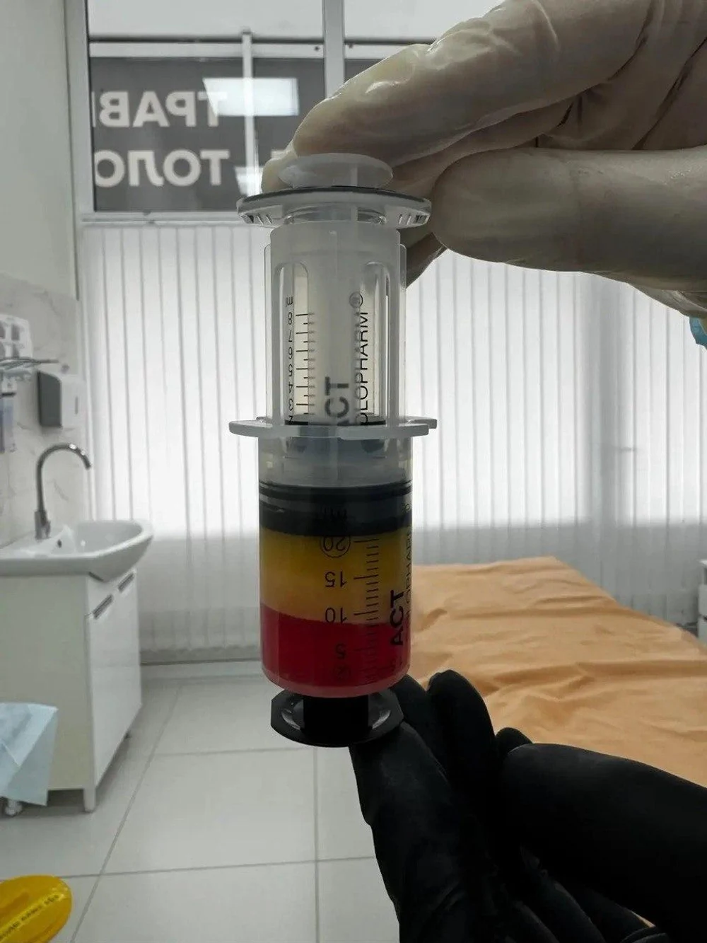 SVF-терапия 
Здоровье ваших суставов.