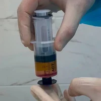 SVF - терапия (безоперационное лечение суставов)